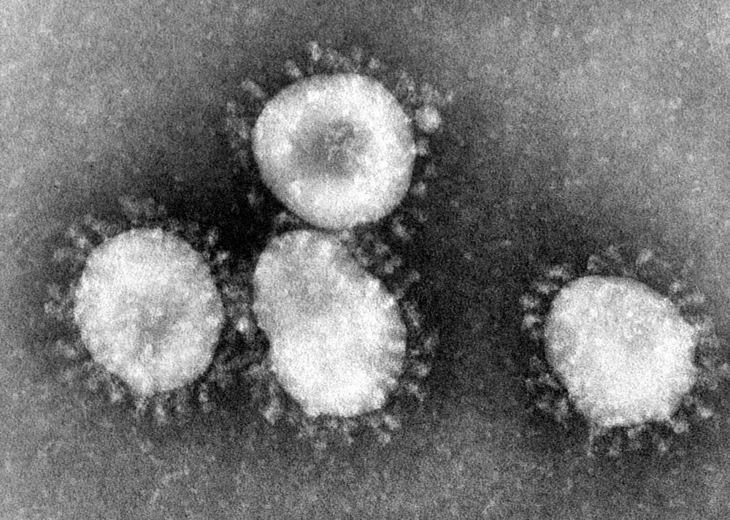 Нов 21 случај на коронавирус во Грција, вкупно 66
