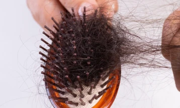 Истражување: Луѓето кои прележале Ковид-19 се соочуваат и со опаѓање на косата