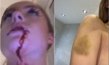 Гринвуд од Манчестер јунајтед ја тепал својата девојка (видео)