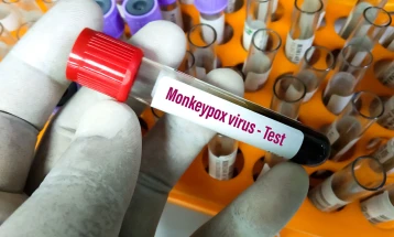 КЗБ препорача мерки за заштита од мајмунски сипаници, се проверува тестот на сомнителниот пациент од Кичево