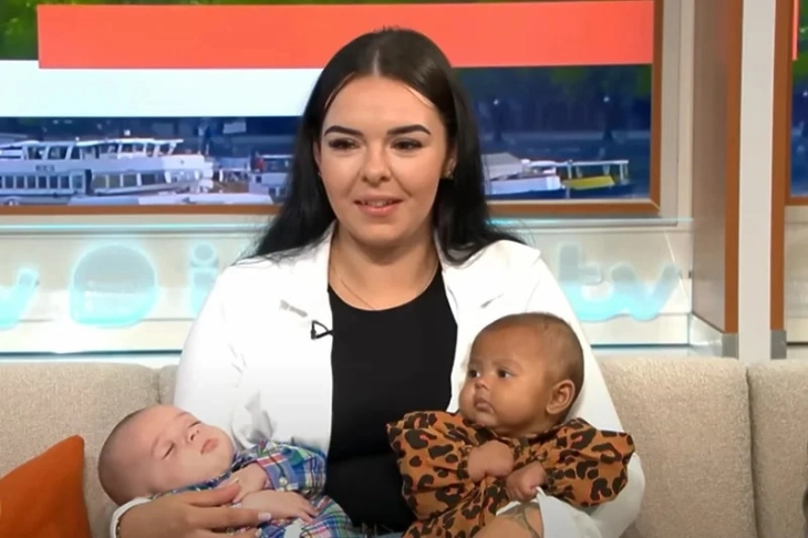 Во Велика Британија родени близнаци со различна боја на кожата