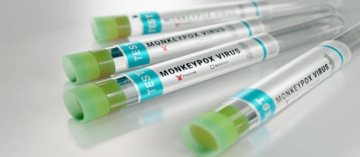 Spain records first monkeypox death