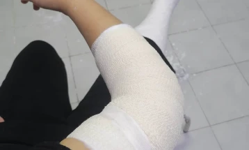 Жена во Тетово ја скрши десната нога и повреди рака во обид да избегне напад на бездомни кучиња