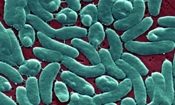 Во САД починаа три лица по инфекција со ретка бактерија