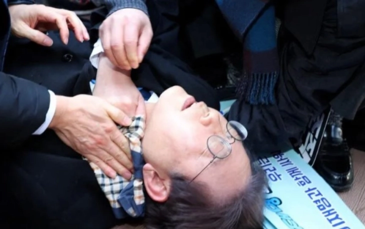 Lideri i opozitës koreanojugore është operuar dhe është me vetëdije pas sulmit me thikë në qafë