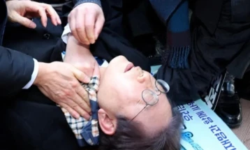 Lideri i opozitës koreanojugore është operuar dhe është me vetëdije pas sulmit me thikë në qafë