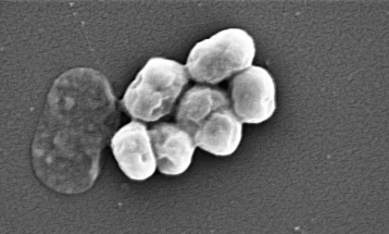 Antibiotiku i ri që vepron kundër superbakterieve vdekjeprurëse