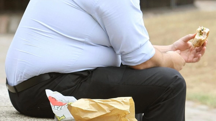 Обезноста причина за хронични болести, во Центарот за менаџирање на дебелина прегледани 730 пациенти
