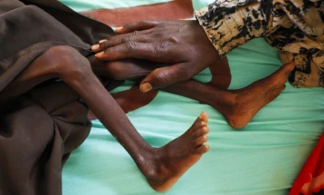 ОН: Речиси 5,9 милиони деца во Нигерија се соочуваат со криза со храна и неухранетост