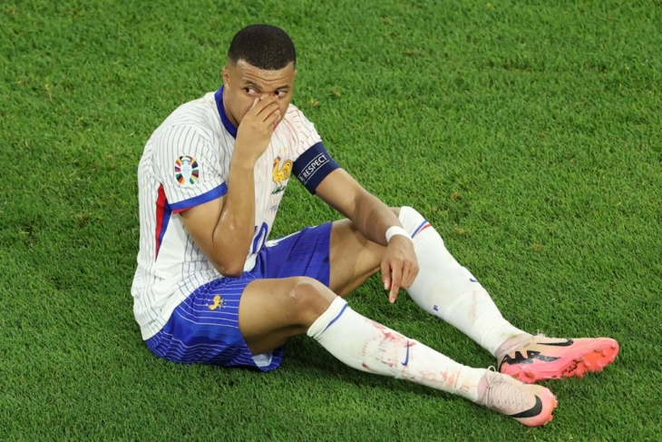 French star Mbappé has a broken nose, but no operation planned yet
