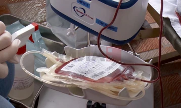 Нема недостаток на крв, информираат од Службата за трансфузиона медицина Куманово