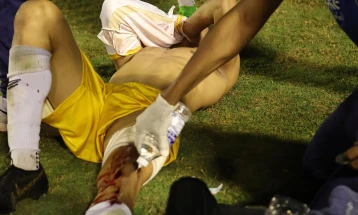 Бразилски полицаец испука гумен куршум во фудбалски голман
