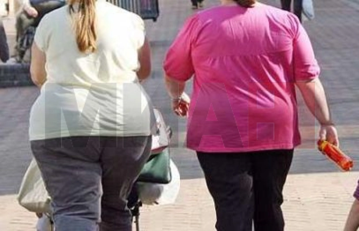 Dita Botërore e Obezitetit, mjekët paralajmërojnë se bëhet fjalë për sëmundje kronike komplekse