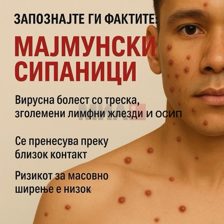 Lija e majmunëve në Maqedoni - epidemiologu Danillovski tha se nuk transmetohet lehtë dhe rreziku është i ulët për epidemi