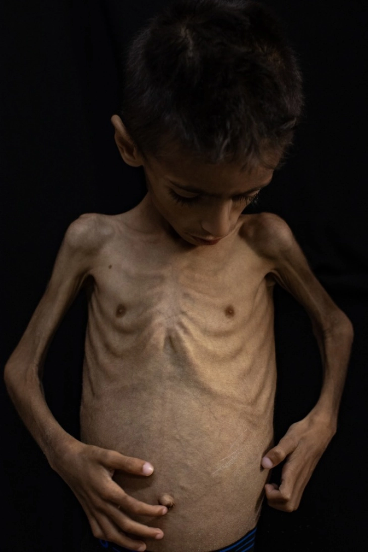 Хуманитарната помош за Појасот Газа не е доволна