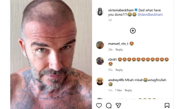 Дејвид Бекам доживеа „несреќен случај“ при потшишување