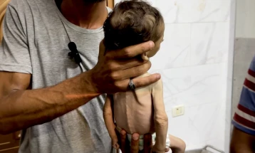 Italy, Croatia opening doors to children from Gaza