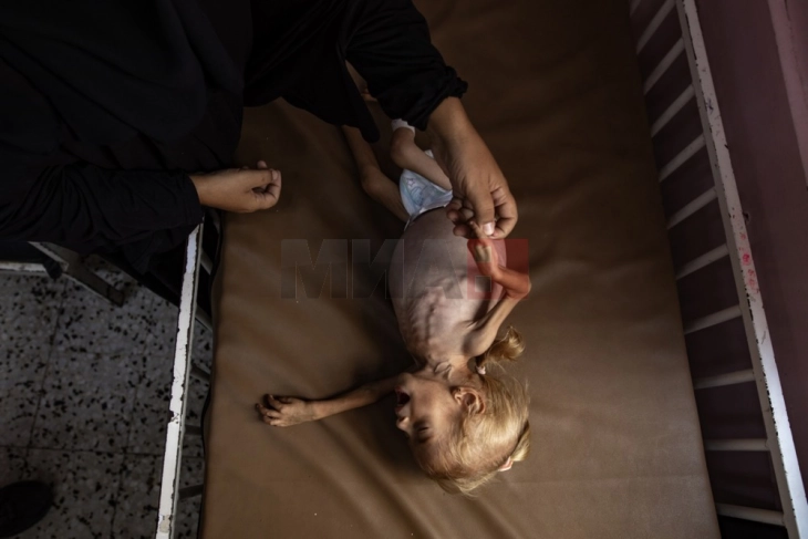 Гутереш: Гладот во Појасот Газа е резултат на намерни постапки на Израел