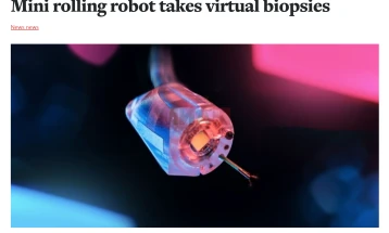 Мини-роботи како безболна замена за колоноскопијата