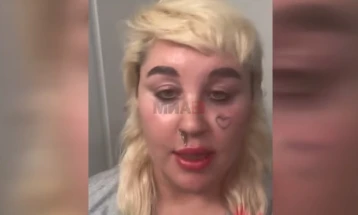 Аманда Бајнс: Земам „Оземпик“ за да бидам слаба и слатка