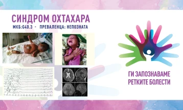 „Ги запознаваме ретките болести“: Синдром Охтахара