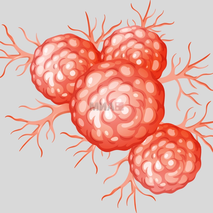 Истражување: Научници открија начин да го сопрат растот на клетките на ракот на дебело црево