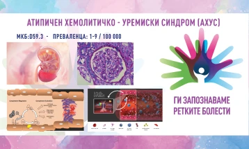 „Ги запознаваме ретките болести“: Типичен хемолитичко-уремиски синдром