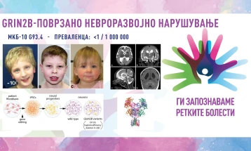 „Ги запознаваме ретките болести“: GRIN2B-поврзано невроразвојно нарушување