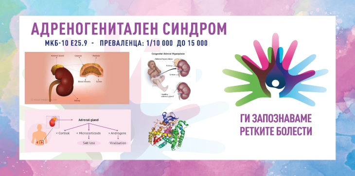 „Ги запознаваме ретките болести“: Конгенитална адренална хиперплазија