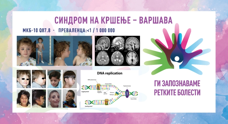 „Ги запознаваме ретките болести“: Синдром на кршење - Варшава