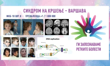 „Ги запознаваме ретките болести“: Синдром на кршење - Варшава