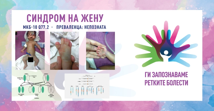 „Ги запознаваме ретките болести“: Синдром на жену