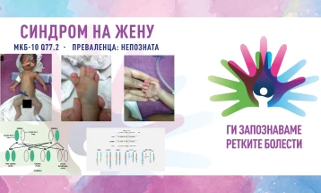 „Ги запознаваме ретките болести“: Синдром на жену