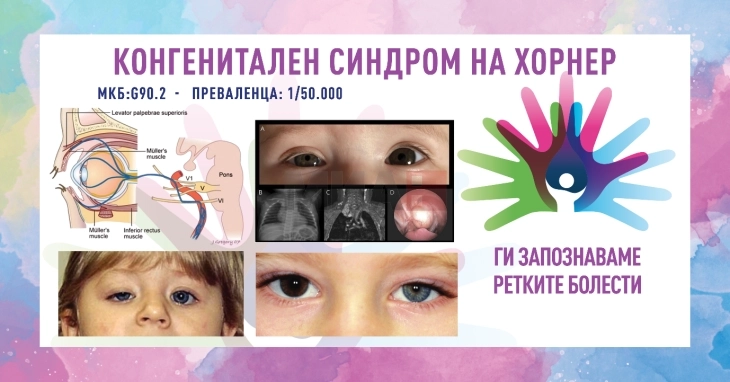 T'i njohim sëmundjet e rralla 2026