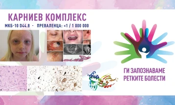 „Ги запознаваме ретките болести“: Карниев комплекс/Бенигна неоплазма на ендокрините жлезди