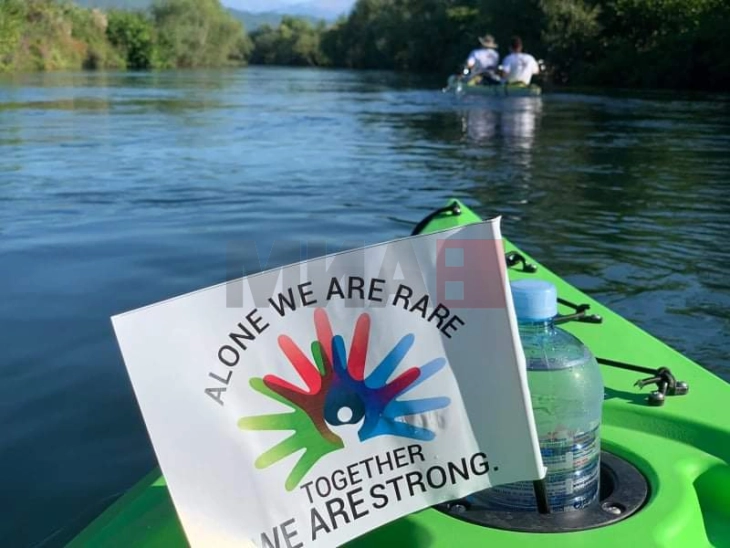 NARBM do ta shëmojë Ditën e Sëmundjeve të Rralla