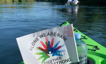 NARBM do ta shëmojë Ditën e Sëmundjeve të Rralla