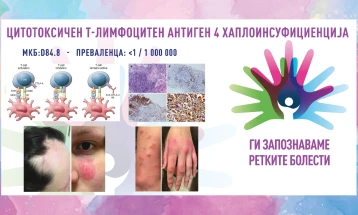 „Ги запознаваме ретките болести“: Цитотоксичен т-лимфоцитен антиген 4 хаплоинсуфициенција