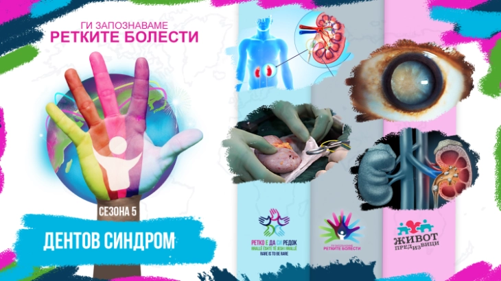 Ретки бубрежни болести: Дентов синдром