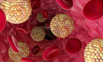 Лекарски совети: Потребни се најмалку шест месеци за значително подобрување на липидниот статус